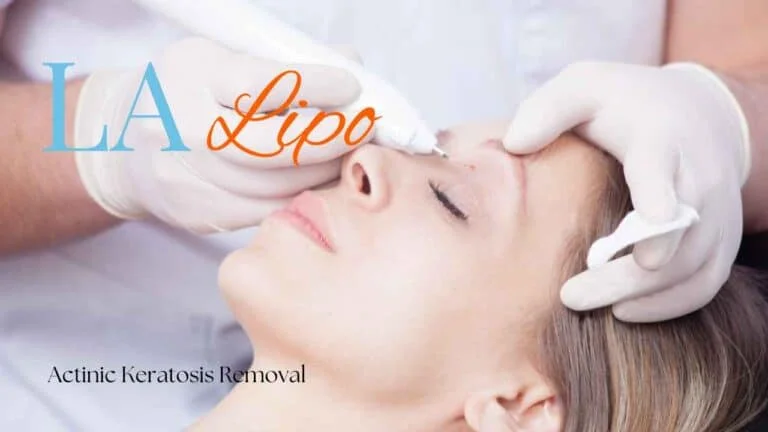 Woman receiving Actinic Keratosis Removal Treatment Diss
