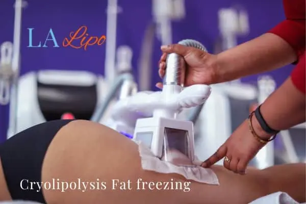 women getting fat freezing Diss