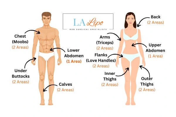 LA LIPO Cryolipolysis Areas Diss