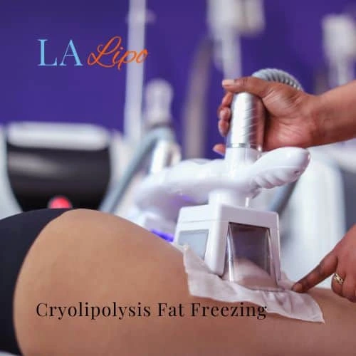 fat freezing - Cryolipolysis Diss