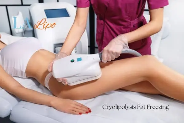 Woman receiving coolsculpting Diss treatment on her thighs