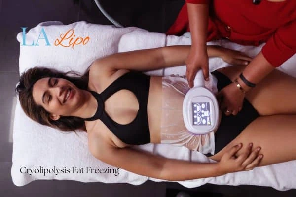 woman getting cryolipolysis Diss