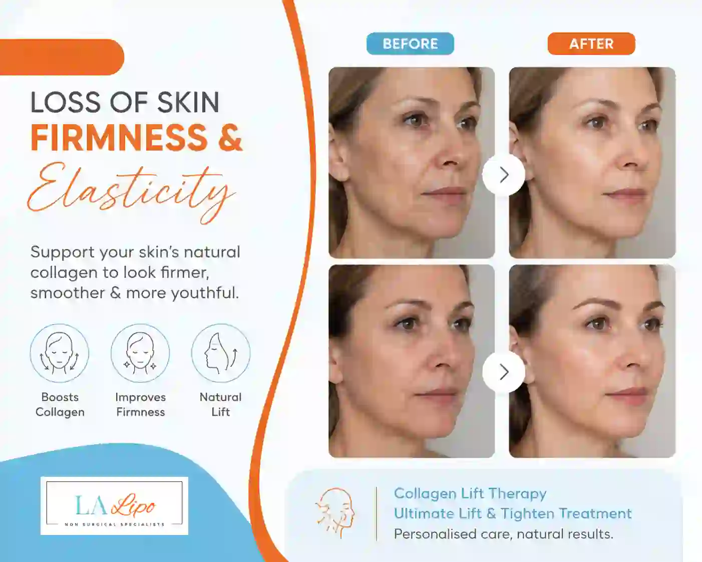 Sign #7: Loss of Skin Firmness and Elasticity Diss